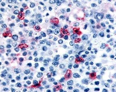 Immunohistochemistry-Paraffin: Histamine H4R Antibody - BSA Free [NLS3775]