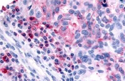 Immunohistochemistry-Paraffin: Histamine H4R Antibody - BSA Free [NLS3775]