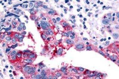 Immunohistochemistry-Paraffin: Histamine H4R Antibody - BSA Free [NLS3775]