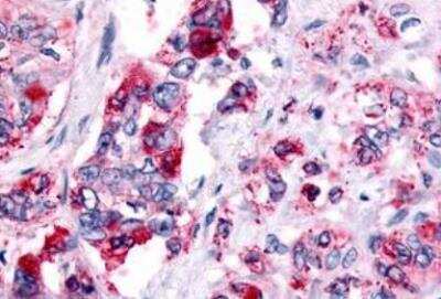 Immunohistochemistry-Paraffin: Histamine H4R Antibody - BSA Free [NLS3775]