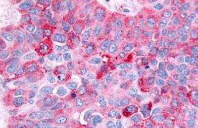 Immunohistochemistry-Paraffin: Histamine H4R Antibody - BSA Free [NLS3775]