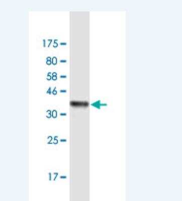 Western Blot: Histamine N-Methyltransferase/HNMT Antibody (2G24) [H00003176-M12-50ug]