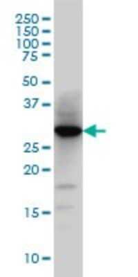 Western Blot: Histamine N-Methyltransferase/HNMT Antibody (3G12) [H00003176-M03]