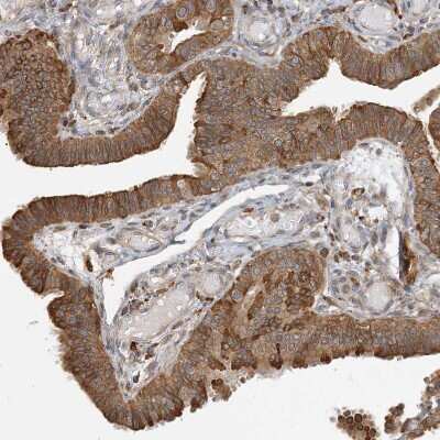 Immunohistochemistry-Paraffin: Histamine N-Methyltransferase/HNMT Antibody [NBP1-89495]