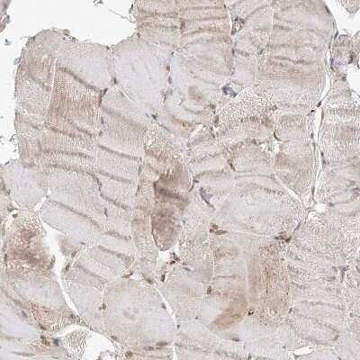 Immunohistochemistry-Paraffin: Histamine N-Methyltransferase/HNMT Antibody [NBP1-89495]