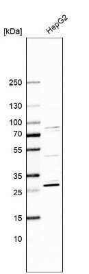 Western Blot: Histamine N-Methyltransferase/HNMT Antibody [NBP1-89495]