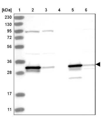 Western Blot: Histamine N-Methyltransferase/HNMT Antibody [NBP2-38253]