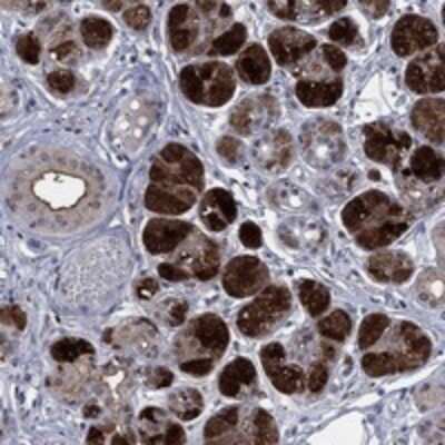 Immunohistochemistry-Paraffin: Histatin 1 Antibody [NBP3-17592]