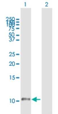 Western Blot: Histatin 1 Antibody [H00003346-B01P]