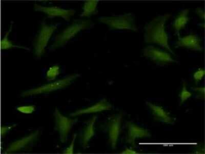 Immunocytochemistry/ Immunofluorescence: Histatin 3 Antibody (4G9) [H00003347-M01]