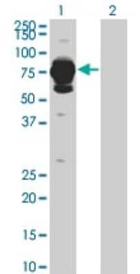 Western Blot: Histidase Antibody (4F2) [H00003034-M04]