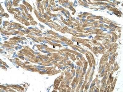 Immunohistochemistry-Paraffin: Histidase Antibody [NBP1-53135]