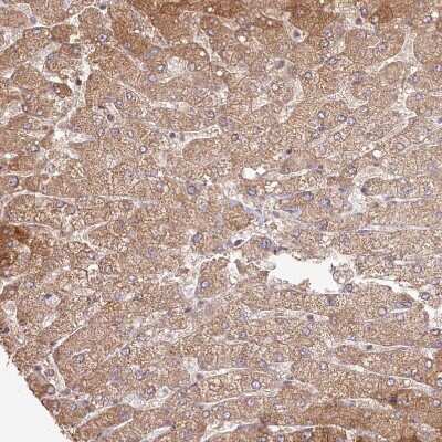 Immunohistochemistry-Paraffin: Histidase Antibody [NBP1-89694]