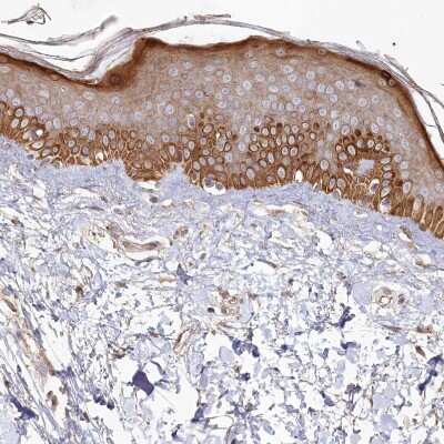 Immunohistochemistry-Paraffin: Histidase Antibody [NBP1-89694]