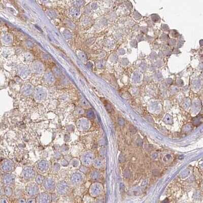 Immunohistochemistry-Paraffin: Histidase Antibody [NBP1-89695]