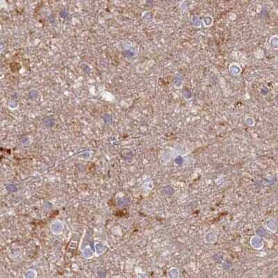 Immunohistochemistry-Paraffin: Histidase Antibody [NBP1-89695]