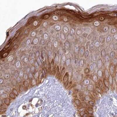 Immunohistochemistry-Paraffin: Histidase Antibody [NBP1-89695]