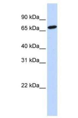 Western Blot: Histidase Antibody [NBP1-53135]