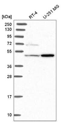 Western Blot: Histidase Antibody [NBP1-89695]