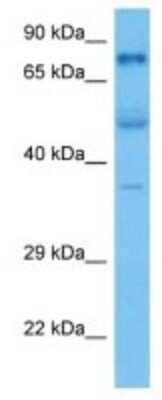 Western Blot: Histidase Antibody [NBP3-10103]