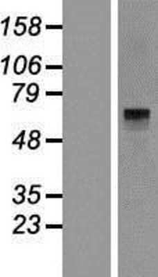 Western Blot: Histidase Overexpression Lysate [NBP2-10781]