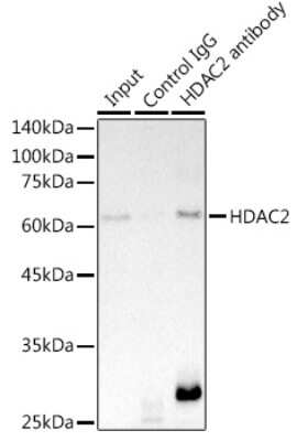 Immunoprecipitation: Histone Deacetylase 2/HDAC2 Antibody (10R7O1) [NBP3-15824]