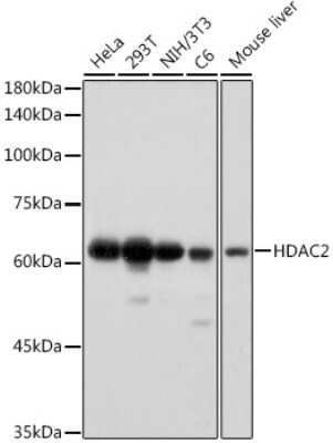 Western Blot: Histone Deacetylase 2/HDAC2 Antibody (10R7O1) [NBP3-15824]