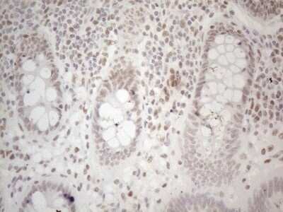 Immunohistochemistry: Histone Deacetylase 2/HDAC2 Antibody (OTI7E10) [NBP2-45949]