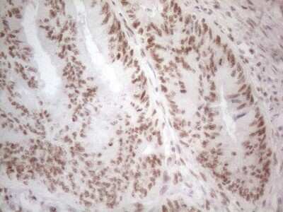 Immunohistochemistry: Histone Deacetylase 2/HDAC2 Antibody (OTI7E10) [NBP2-45949]