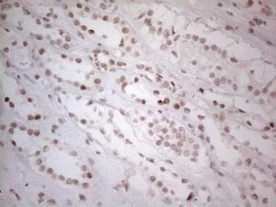 Immunohistochemistry: Histone Deacetylase 2/HDAC2 Antibody (OTI7E10) [NBP2-45949]