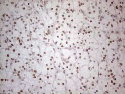 Immunohistochemistry: Histone Deacetylase 2/HDAC2 Antibody (OTI7E10) [NBP2-45949]
