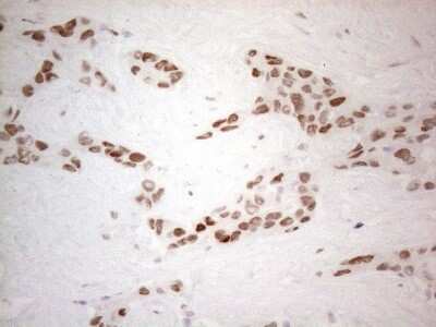 Immunohistochemistry: Histone Deacetylase 2/HDAC2 Antibody (OTI7E10) [NBP2-45949]