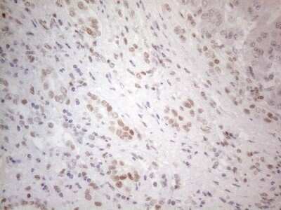 Immunohistochemistry: Histone Deacetylase 2/HDAC2 Antibody (OTI7E10) [NBP2-45949]