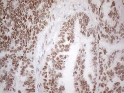 Immunohistochemistry: Histone Deacetylase 2/HDAC2 Antibody (OTI7E10) [NBP2-45949]