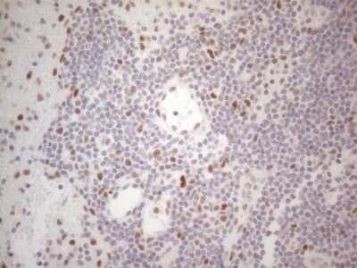 Immunohistochemistry: Histone Deacetylase 2/HDAC2 Antibody (OTI7E10) [NBP2-45949]