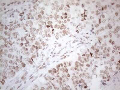 Immunohistochemistry: Histone Deacetylase 2/HDAC2 Antibody (OTI7E10) [NBP2-45949]