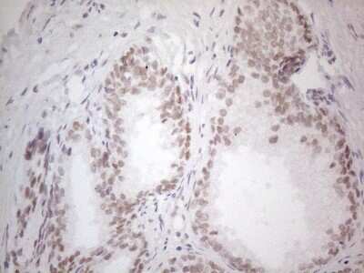Immunohistochemistry: Histone Deacetylase 2/HDAC2 Antibody (OTI7E10) [NBP2-45949]