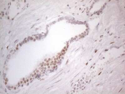 Immunohistochemistry: Histone Deacetylase 2/HDAC2 Antibody (OTI7E10) [NBP2-45949]