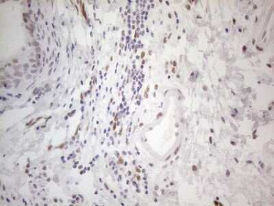 Immunohistochemistry: Histone Deacetylase 2/HDAC2 Antibody (OTI7E10) [NBP2-45949]