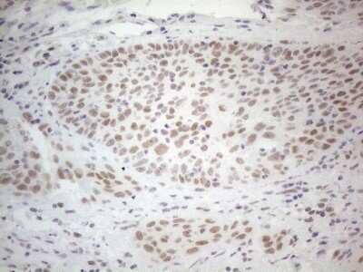 Immunohistochemistry: Histone Deacetylase 2/HDAC2 Antibody (OTI7E10) [NBP2-45949]