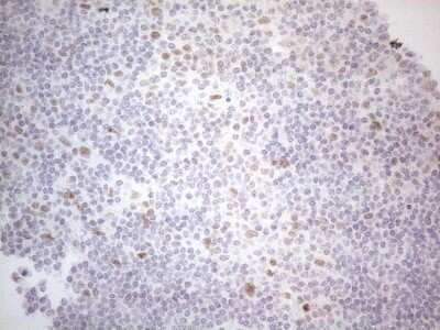 Immunohistochemistry: Histone Deacetylase 2/HDAC2 Antibody (OTI7E10) [NBP2-45949]