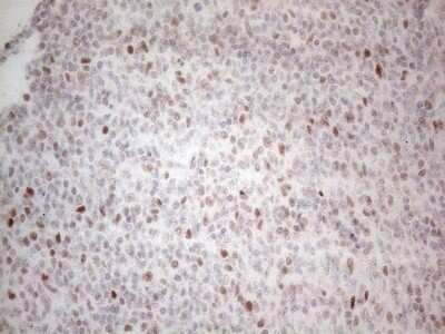 Immunohistochemistry: Histone Deacetylase 2/HDAC2 Antibody (OTI7E10) [NBP2-45949]