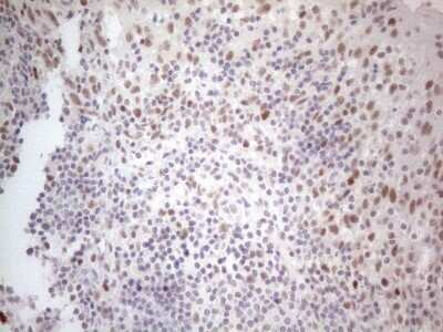 Immunohistochemistry: Histone Deacetylase 2/HDAC2 Antibody (OTI7E10) [NBP2-45949]