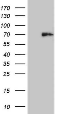 Western Blot: Histone Deacetylase 2/HDAC2 Antibody (OTI7E10) [NBP2-45949]