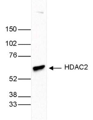 Western Blot: Histone Deacetylase 2/HDAC2 Antibody (C.15200201) [NBP2-59269]