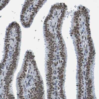 Immunohistochemistry-Paraffin: Histone Deacetylase 2/HDAC2 Antibody [NBP1-87109]