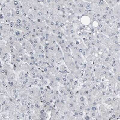 Immunohistochemistry-Paraffin: Histone Deacetylase 2/HDAC2 Antibody [NBP1-87109]