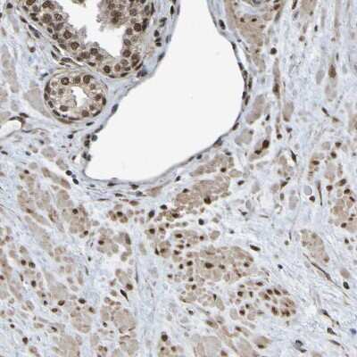 Immunohistochemistry-Paraffin: Histone Deacetylase 2/HDAC2 Antibody [NBP1-87109]