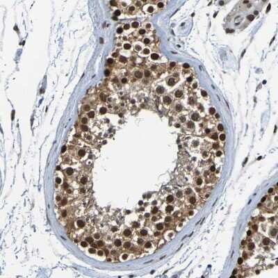 Immunohistochemistry-Paraffin: Histone Deacetylase 2/HDAC2 Antibody [NBP1-87109]