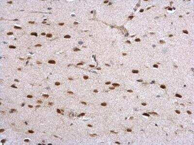Immunohistochemistry-Paraffin: Histone Deacetylase 2/HDAC2 Antibody [NBP2-16790]